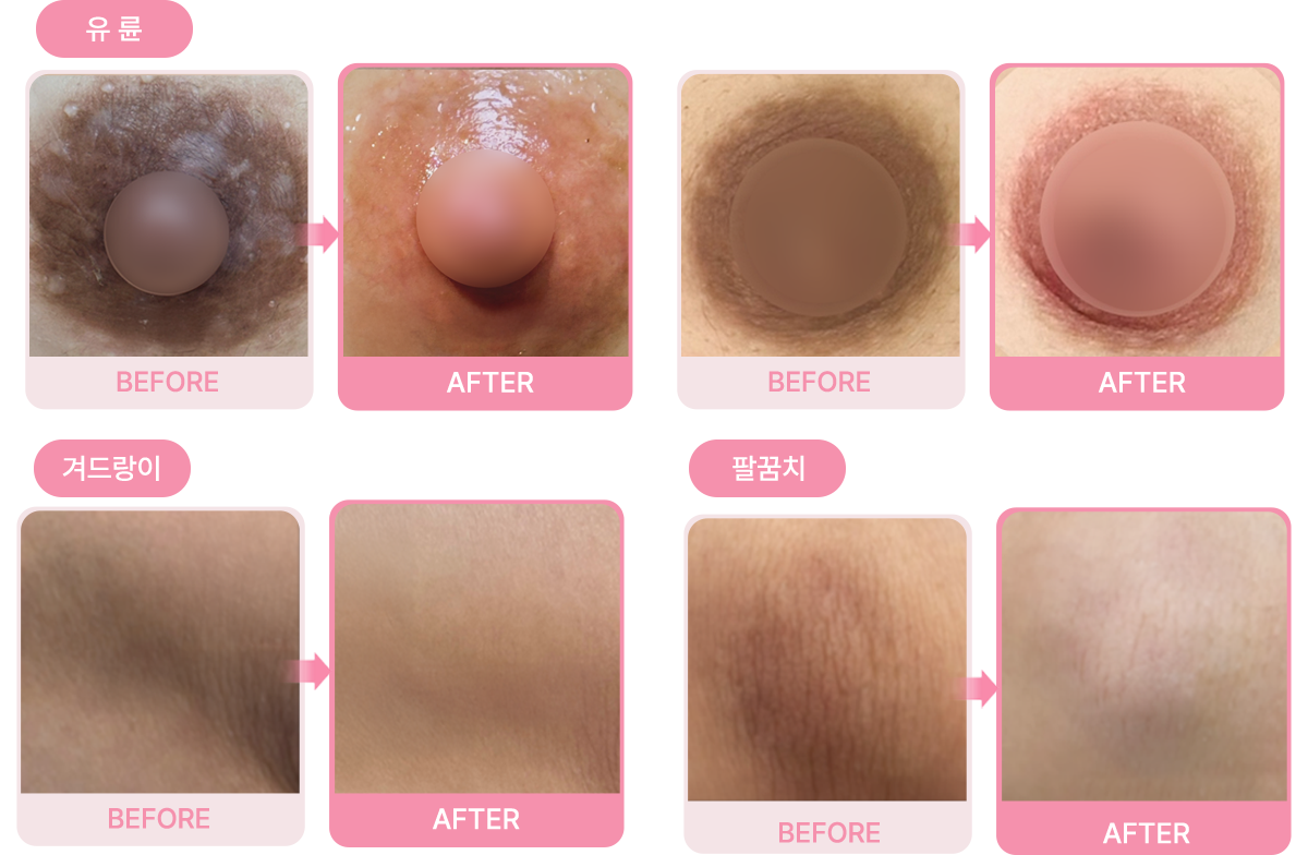 Before & After 결과 사진
